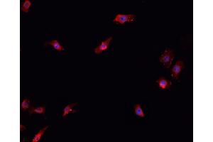 ABIN6266706 staining K-562 cells by IF/ICC. (T-Box 1 Antikörper  (C-Term))