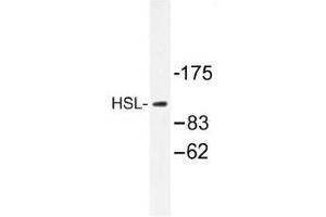 Image no. 1 for anti-Lipase, Hormone-Sensitive (LIPE) antibody (ABIN317711) (LIPE Antikörper)
