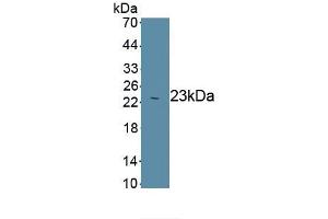 Detection of Recombinant Smad3, Human using Monoclonal Antibody to SMAD family member 3 (SMAD3) (SMAD3 Antikörper  (AA 231-425))