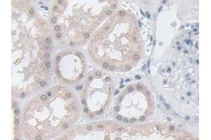 Immunohistochemistry (IHC) image for anti-Glutathione Peroxidase 3 (Plasma) (GPX3) (AA 21-72) antibody (ABIN7435298)
