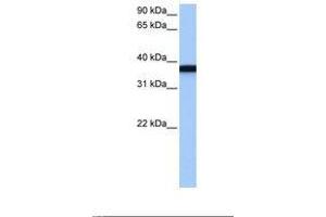 Image no. 1 for anti-Germ Cell Associated 1 (GSG1) (C-Term) antibody (ABIN6738917) (GSG1 Antikörper  (C-Term))