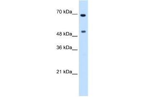 WB Suggested Anti-MYC Antibody Titration:  0. (c-MYC Antikörper  (N-Term))