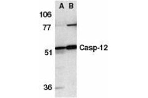 Western blot analysis of caspase-12 in human (A) and mouse (B) spleen tissue lysates with AP30190PU-N caspase-12 antibody at 1 μg/ml. (Caspase 12 Antikörper  (N-Term))