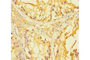 Immunohistochemistry of paraffin-embedded human testis tissue using ABIN7166699 at dilution of 1:100 (PAGE2B Antikörper  (AA 1-111))