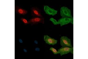 ABIN6263105 and ABIN6272810 staining  cells(H2O2 treatment) by IF/ICC.