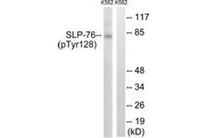 Western blot analysis of extracts from K562 cells treated with Na3VO4 0. (LCP2 Antikörper  (pTyr128))