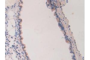 Immunohistochemistry (IHC) image for anti-Laminin, alpha 4 (LAMa4) (AA 745-940) antibody (ABIN7438163)