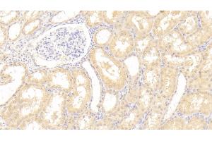 Immunohistochemistry (IHC) image for anti-Vascular Endothelial Growth Factor B (VEGFB) (AA 22-207) antibody (ABIN7429442)