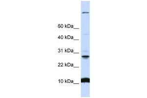WB Suggested Anti-C19orf56 Antibody Titration:  0.