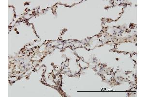 Immunoperoxidase of monoclonal antibody to EML2 on formalin-fixed paraffin-embedded human lung. (EML2 Antikörper  (AA 1-427))