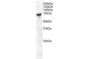 Image no. 2 for anti-B-Cell Linker (BLNK) (C-Term) antibody (ABIN374092) (B-Cell Linker Antikörper  (C-Term))