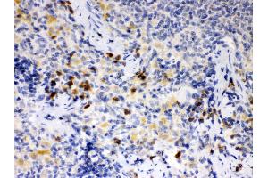 Anti- ATG14L Picoband antibody, IHC(P) IHC(P): Rat Spleen Tissue (ATG14 Antikörper  (N-Term))