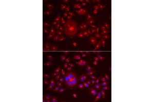 Immunofluorescence analysis of A549 cell using GORASP1 antibody. (GORASP1 Antikörper)