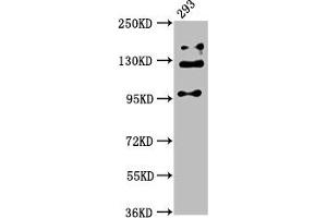Western Blot Positive WB detected in: 293 whole cell lysate All lanes: RAB3GAP2 antibody at 5 μg/mL Secondary Goat polyclonal to rabbit IgG at 1/50000 dilution Predicted band size: 156, 24 kDa Observed band size: 110, 130, 150 kDa (RAB3GAP2 Antikörper  (Catalytic Subunit))