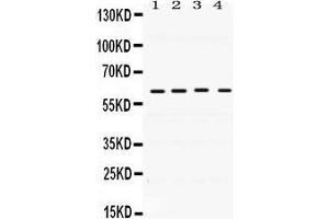 Western Blotting (WB) image for anti-BCL2-Associated Athanogene 3 (BAG3) (AA 100-561) antibody (ABIN3042341)