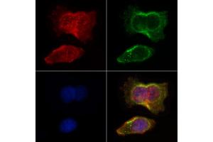 ABIN6264652 and ABIN6266628 staining HepG2 by IF/ICC. (RASH/RASK/RASN (N-Term) Antikörper)