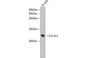 Western blot analysis of extracts of B-cell cells, using CCL3L1 antibody (ABIN3016836, ABIN3016837, ABIN3016838 and ABIN6219853) at 1:1000 dilution. (CCL3L1 Antikörper  (AA 24-93))