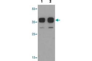 Western blot analysis of TSPY1 in A-20 cell lysate with TSPY1 polyclonal antibody  at (1) 0. (TSPY1 Antikörper  (C-Term))