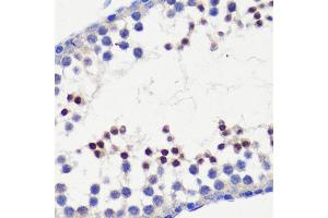 Immunohistochemistry of paraffin-embedded mouse testis using HFM1 antibody (ABIN6133318, ABIN6141741, ABIN6141743 and ABIN6224711) at dilution of 1:100 (40x lens). (HFM1 Antikörper  (AA 1-240))