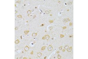 Immunohistochemistry of paraffin-embedded rat brain using CHRNA7 antibody. (CHRNA7 Antikörper)