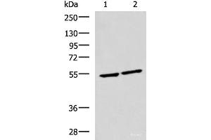 Western blot analysis of Raji and Jurkat cell lysates using IRF2 Polyclonal Antibody at dilution of 1:1350 (IRF2 Antikörper)