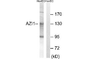 Immunohistochemistry analysis of paraffin-embedded human breast carcinoma tissue using AZI1 antibody. (AZI1 Antikörper)
