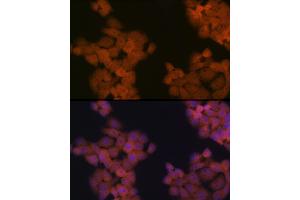 Immunofluorescence analysis of HeLa cells using CDC23 Rabbit mAb (ABIN7266247) at dilution of 1:100 (40x lens). (CDC23 Antikörper)