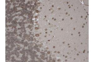 Immunohistochemistry (IHC) image for anti-Transient Receptor Potential Cation Channel, Subfamily M, Member 7 (TRPM7) (AA 1817-1863) antibody (Atto 594) (ABIN2483107)