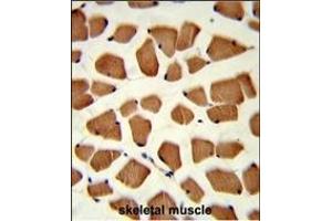 Formalin-fixed and paraffin-embedded human skeletal muscle reacted with TBC1D4 Antibody (N-term), which was peroxidase-conjugated to the secondary antibody, followed by DAB staining.
