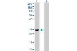 Western Blot analysis of RAB39 expression in transfected 293T cell line by RAB39 MaxPab polyclonal antibody. (RAB39 Antikörper  (AA 1-217))