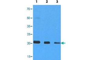 Western blot analysis of 293T cell extracts (35 ug) with NRAS monoclonal antibody, clone AT2G9  at 1:500 (Lane 1), 1:1000 (Lane 2) and 1:5000 (Lane 3) dilution.