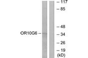 Western blot analysis of extracts from COLO cells, using OR10G6 Antibody. (OR10G6 Antikörper  (AA 261-310))