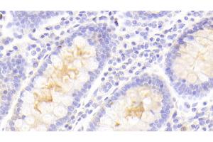 Detection of PLIN4 in Human Colon Tissue using Polyclonal Antibody to Perilipin 4 (PLIN4) (PLIN4 Antikörper  (AA 349-656))