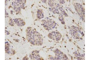 Immunohistochemistry (IHC) image for anti-Proteasome (Prosome, Macropain) 26S Subunit, Non-ATPase, 2 (PSMD2) antibody (ABIN1874389) (PSMD2 Antikörper)