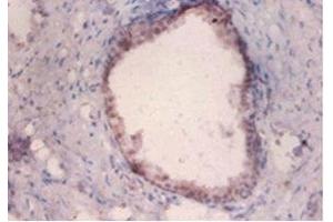 Immunohistochemistry of paraffin-embedded human prostate tissue using ABIN7159368 at dilution of 1:100 (PKMYT1 Antikörper  (AA 900-1101))