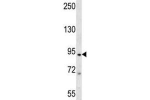 Western Blotting (WB) image for anti-Transporter 1, ATP-Binding Cassette, Sub-Family B (MDR/TAP) (TAP1) (AA 765-794) antibody (ABIN3029262)