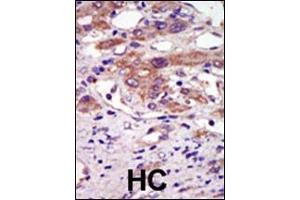 Immunohistochemistry (Paraffin-embedded Sections) (IHC (p)) image for anti-Ribosomal Protein S6 Kinase, 90kDa, Polypeptide 6 (RPS6KA6) (AA 15-45), (N-Term) antibody (ABIN1882127)