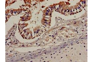 Immunohistochemistry analysis of human lung tissue using ABIN7145942 at dilution of 1:100 (CCR7 Antikörper  (AA 332-378))