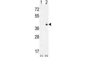 Western Blotting (WB) image for anti-Galactokinase 1 (GALK1) antibody (ABIN3002977) (GALK1 Antikörper)