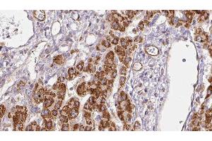 Immunohistochemistry (IHC) image for anti-Solute Carrier Family 9, Subfamily A (NHE3, Cation Proton Antiporter 3), Member 3 Regulator 1 (SLC9A3R1) (Internal Region) antibody (ABIN6265156)