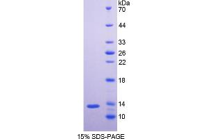 SDS-PAGE analysis of Mouse NEFL Protein. (Neurofilament, Light Polypeptide (NEFL) Peptid)