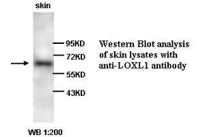 Image no. 1 for anti-Lysyl Oxidase-Like 1 (LOXL1) antibody (ABIN790876) (LOXL1 Antikörper)