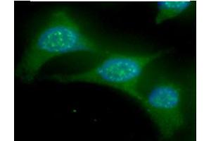 ICC/IF analysis of UBE2L6 in HeLa cells line, stained with DAPI (Blue) for nucleus staining and monoclonal anti-human UBE2L6 antibody (1:100) with goat anti-mouse IgG-Alexa fluor 488 conjugate (Green). (UBE2L6 Antikörper)