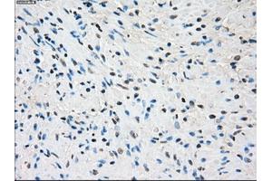 Image no. 2 for anti-Synovial Sarcoma, X Breakpoint 2 (SSX2) antibody (ABIN1501161)