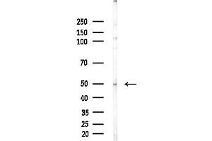 anti-S100 Calcium Binding Protein A5 (S100A5) antibody