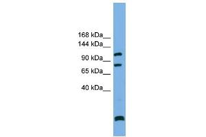 WB Suggested Anti-PPP6R1 Antibody Titration: 0. (SAPS1 Antikörper  (N-Term))
