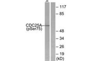 Western Blotting (WB) image for anti-Cell Division Cycle 25 Homolog A (S. Pombe) (CDC25A) (pSer75) antibody (ABIN2888378) (CDC25A Antikörper  (pSer75))