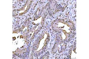 IHC analysis of FEN1 using anti-FEN1 antibody (ABIN7601617). (FEN1 Antikörper  (AA 4-300))