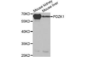 Western Blotting (WB) image for anti-PDZ Domain Containing 1 (PDZK1) antibody (ABIN1876509) (PDZK1 Antikörper)
