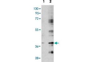 Western blot analysis of BIRC7 (arrow) using rabbit BIRC7 polyclonal antibody . (BIRC7 Antikörper  (C-Term))